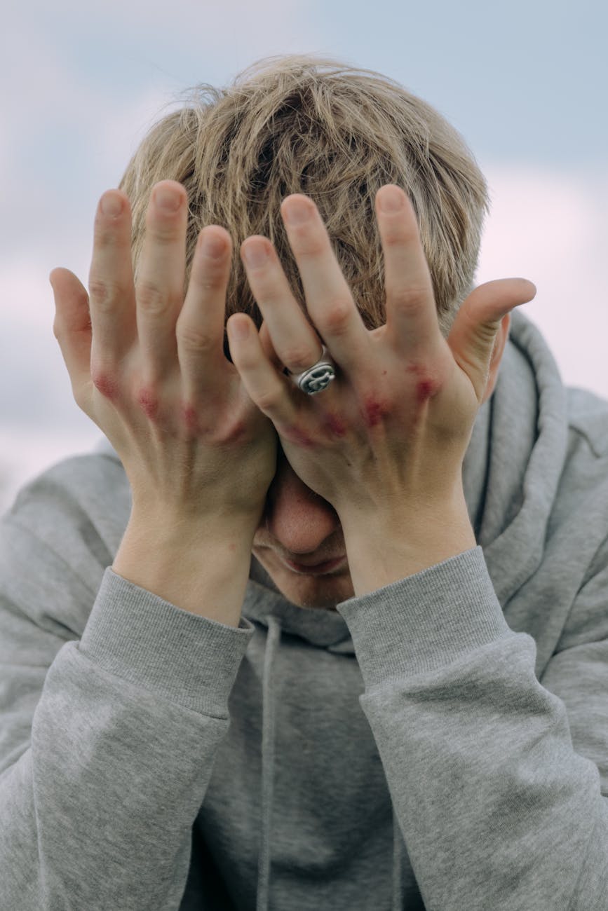 a man with bruised knuckles having a headache